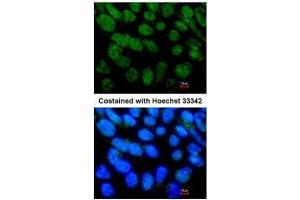 ICC/IF Image Immunofluorescence analysis of paraformaldehyde-fixed Human ESC, using NR5A2, antibody at 1:400 dilution. (NR5A2 + LRH1 抗体)
