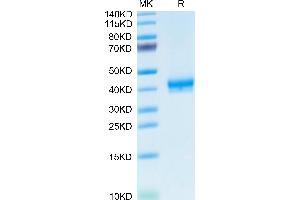 Human CADM3 on Tris-Bis PAGE under reduced condition. (CADM3 Protein (AA 25-329) (His tag))
