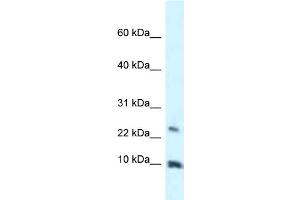 WB Suggested Anti-HMGN3 Antibody Titration: 1. (HMGN3 抗体  (Middle Region))