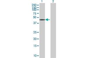 Western Blot analysis of C10orf88 expression in transfected 293T cell line by C10orf88 MaxPab polyclonal antibody. (C10orf88 抗体  (AA 1-445))