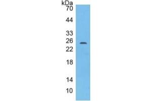 Rabbit Detection antibody from the kit in WB with Positive Control: Human Cartilage lysate. (IL17F CLIA Kit)