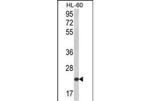 Western blot analysis of KLRC2 Antibody (N-term) (ABIN652570 and ABIN2842383) in HL-60 cell line lysates (35 μg/lane). (KLRC2 抗体  (N-Term))
