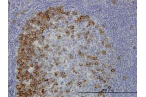 Image no. 1 for anti-Transforming, Acidic Coiled-Coil Containing Protein 3 (TACC3) (AA 1-101) antibody (ABIN6745991) (TACC3 抗体  (AA 1-101))