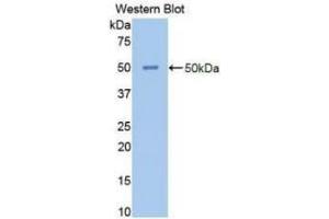 Detection of Recombinant NSE, Human using Polyclonal Antibody to Enolase, Neuron Specific (NSE) (ENO2/NSE 抗体  (AA 1-434))