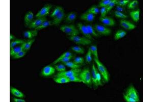 Immunofluorescent analysis of HepG2 cells using ABIN7153335 at dilution of 1:100 and Alexa Fluor 488-congugated AffiniPure Goat Anti-Rabbit IgG(H+L) (GPR183 抗体  (AA 1-31))