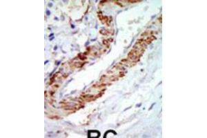 Immunohistochemistry (IHC) image for anti-Carnitine O-Octanoyltransferase (CROT) (AA 414-445), (C-Term) antibody (ABIN5534058)