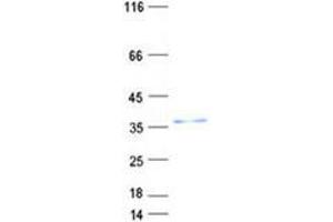 Western Blotting (WB) image for Ventral Anterior Homeobox 2 (VAX2) protein (His tag) (ABIN5505801)