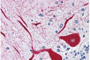 Human Brain, Cerebellum (formalin-fixed, paraffin-embedded) stained with ITPR1 antibody ABIN337359 at 5 ug/ml followed by biotinylated goat anti-rabbit IgG secondary antibody ABIN481713, alkaline phosphatase-streptavidin and chromogen.