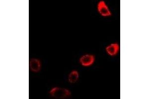 Immunofluorescent analysis of Neuroglobin staining in U2OS cells. (Neuroglobin 抗体)