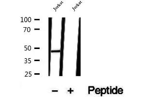 Western blot analysis of extracts of Jurkat cells, using TIMM44 antibody. (TIMM44 抗体  (N-Term))