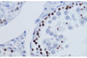 Immunohistochemistry of paraffin-embedded Rat testis using TriMethyl-Histone H3-K9 Polyclonal Antibody at dilution of 1:200 (40x lens). (Histone 3 抗体  (3meLys9))
