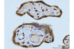 IHC analysis of SCP3/SYCP3 using anti-SCP3/SYCP3 antibody (ABIN7602415). (SYCP3 抗体  (AA 75-236))