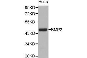Western blot analysis of extracts of HeLa cell lines, using BMP2 antibody. (BMP2 抗体)