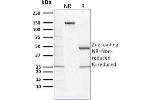 SDS-PAGE (SDS) image for anti-SRY (Sex Determining Region Y)-Box 9 (SOX9) (AA 393-508) antibody (ABIN6940619)