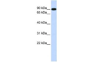 Western Blotting (WB) image for anti-Zinc Finger, X-Linked, Duplicated A (ZXDA) antibody (ABIN2458346) (ZXDA 抗体)