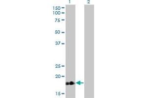 Western Blot analysis of TNNC1 expression in transfected 293T cell line by TNNC1 monoclonal antibody (M01), clone 1F8-A9. (TNNC1 抗体  (AA 1-161))
