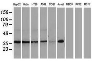 Image no. 6 for anti-Nonhomologous End-Joining Factor 1 (NHEJ1) antibody (ABIN1499728)