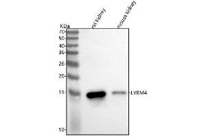 Western blot analysis of LYRM4 using anti-LYRM4 antibody (ABIN7599573).