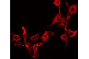 ABIN6279255 staining A549 by IF/ICC. (CPZ 抗体  (Internal Region))