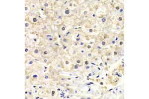 Immunohistochemistry of paraffin-embedded human liver injury using FKBP4 Antibody (ABIN5973289) at dilution of 1/200 (40x lens). (FKBP4 抗体)