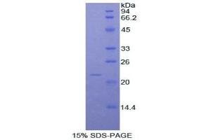 SDS-PAGE of Protein Standard from the Kit (Highly purified E. (NOS2 ELISA 试剂盒)