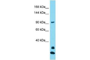 Western Blotting (WB) image for anti-Janus Kinase and Microtubule Interacting Protein 3 (JAKMIP3) (N-Term) antibody (ABIN2791597) (JAKMIP3 抗体  (N-Term))