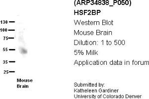 Image no. 1 for anti-Heat Shock Transcription Factor 2 Binding Protein (HSF2BP) (N-Term) antibody (ABIN2776048) (HSF2BP 抗体  (N-Term))