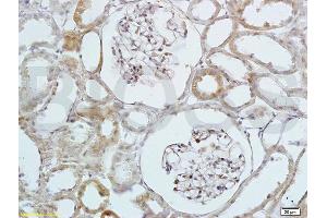 Formalin-fixed and paraffin embedded rat kidney labeled with Anti-HB EGF Polyclonal Antibody, Unconjugated (ABIN701050) at 1:200 followed by conjugation to the secondary antibody and DAB staining (HBEGF 抗体  (AA 51-150))