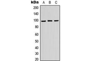 Western Blotting (WB) image for anti-ATPase, H+ Transporting, Lysosomal V0 Subunit A2 (ATP6V0A2) (Center) antibody (ABIN7300390)