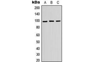 Western blot analysis of ATP6V0A2 expression in HEK293T (A), Raw264. (ATP6V0A2 抗体  (Center))