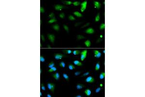 Immunofluorescence analysis of HeLa cell using F11R antibody. (F11R 抗体  (AA 30-238))