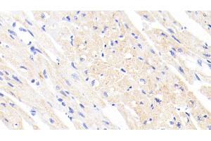 Detection of FECH in Human Cardiac Muscle Tissue using Polyclonal Antibody to Ferrochelatase (FECH) (FECH 抗体  (AA 55-423))