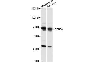 Western blot analysis of extracts of various cell lines, using CPNE6 antibody (ABIN6291377) at 1:3000 dilution. (CPNE6 抗体)