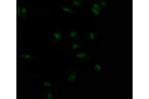 Immunofluorescence staining of MCF7 Cells with ABIN7127575 at 1:50, counter-stained with DAPI. (Recombinant Insulin Receptor 抗体)