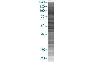 OXSR1 transfected lysate. (OXSR1 293T Cell Transient Overexpression Lysate(Denatured))