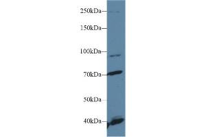 Western Blot; Sample: Human Hela cell lysate; Primary Ab: 1µg/ml Rabbit Anti-Human FGFR2 Antibody Second Ab: 0. (FGFR2 抗体  (AA 157-377))