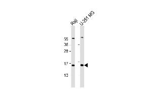 Western Blot at 1:2000 dilution Lane 1: Raji whole cell lysate Lane 2: U-251 MG whole cell lysate Lysates/proteins at 20 ug per lane.