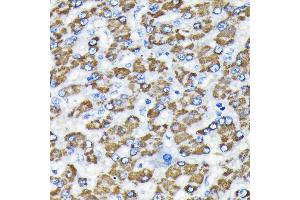 Immunohistochemistry (IHC) image for anti-SMAD, Mothers Against DPP Homolog 3 (SMAD3) antibody (ABIN7270349)