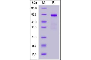 SDS-PAGE (SDS) image for Asialoglycoprotein Receptor 1 (ASGR1) (AA 62-291) protein (Fc Tag) (ABIN7013614)