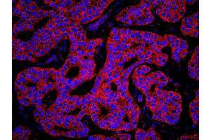 anti-Lysyl-tRNA Synthetase (KARS) (C-Term) antibody
