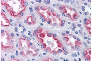 Human Kidney: Formalin-Fixed, Paraffin-Embedded (FFPE)