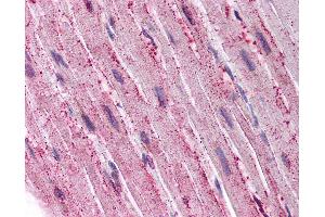 Anti-ADAMTS4 antibody IHC of human heart.