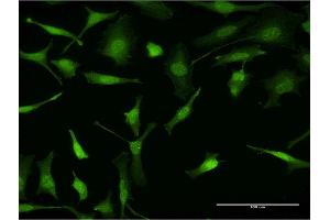 Immunofluorescence of monoclonal antibody to PURA on HeLa cell. (PURA 抗体  (AA 183-292))