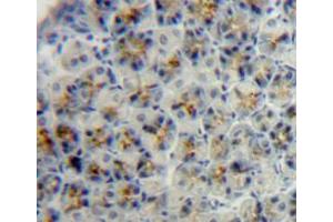 IHC-P analysis of adrenal tissue, with DAB staining.