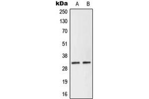 Western blot analysis of NEURL2 expression in Human Placenta (A), KNRK (B) whole cell lysates. (NEURL2 抗体  (Center))