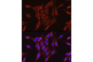 Immunofluorescence analysis of PC-12 cells using [KO Validated] Glutamine Synthetase (GLUL) Rabbit pAb (ABIN6130425, ABIN6141161, ABIN6141162 and ABIN7101772) at dilution of 1:100 (40x lens).
