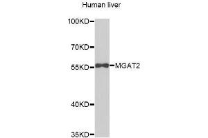 Western blot analysis of extracts of Human liver cells, using MGAT2 antibody. (MGAT2 抗体)