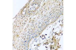 Immunohistochemistry of paraffin-embedded human esophagus using NDUFA2 antibody at dilution of 1:100 (x40 lens). (NDUFA2 抗体)