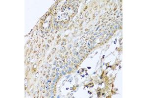 Immunohistochemistry of paraffin-embedded human esophagus using NDUFA2 antibody at dilution of 1:100 (x40 lens).