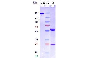 Anti-CSF2 / GM-CSF Reference Antibody (lenzilumab) on SDS-PAGE under reducing (R) condition. (Recombinant CSF2 (Lenzilumab Biosimilar) 抗体)